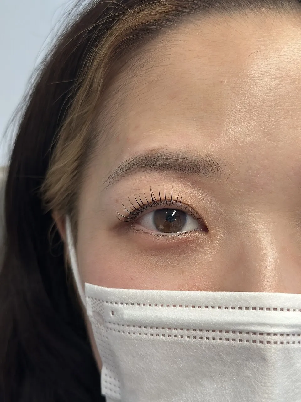 施術事例